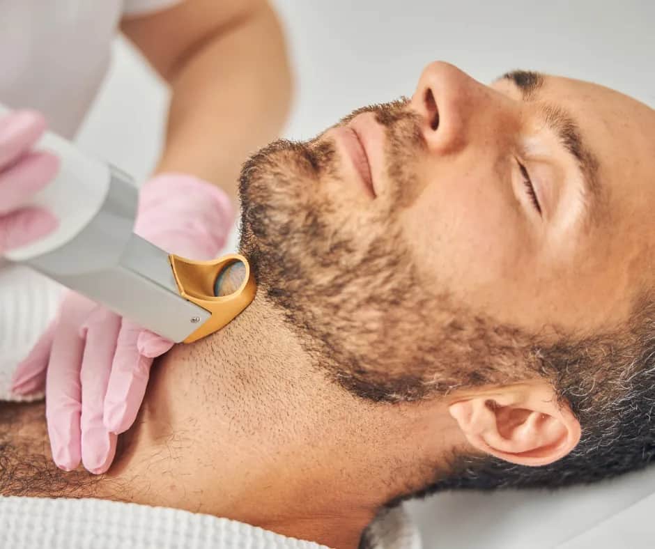 Trwała gładkość brody: ile zabiegów laserem? Odpowiedź eksperta.