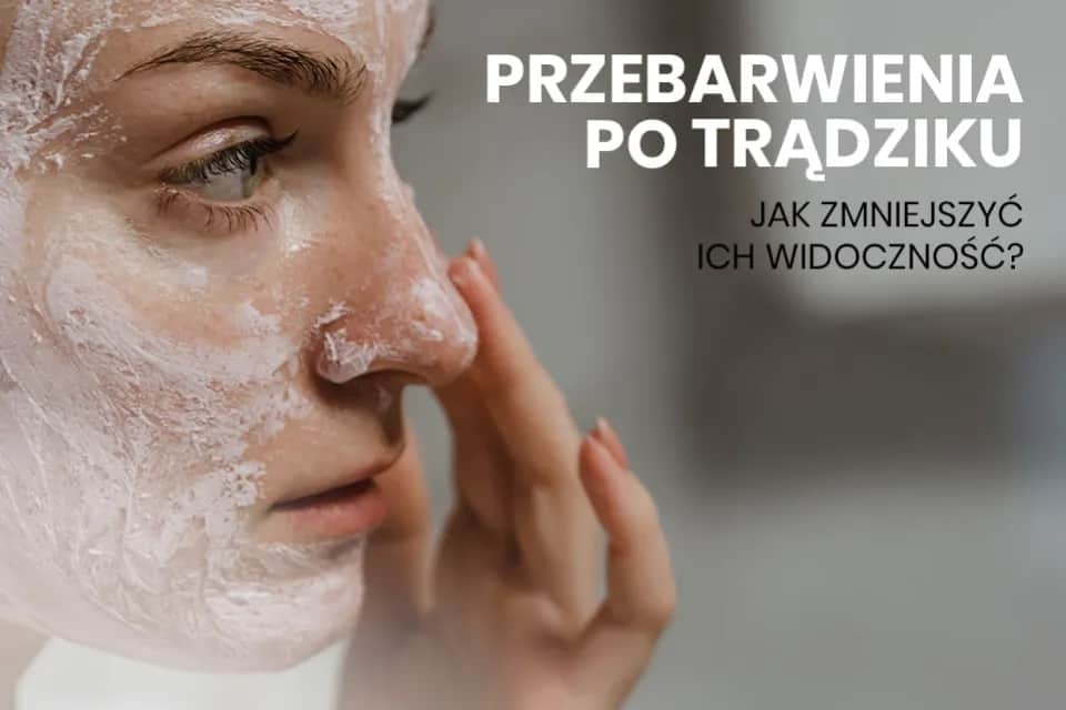 Jak pozbyć się blizn po pryszczach? Domowe i profesjonalne metody