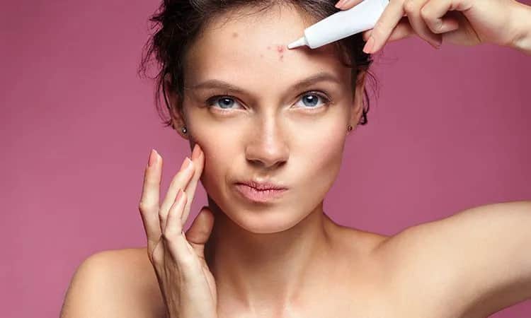 Jak pozbyć się pryszczy? Kompleksowy poradnik dla gładkiej cery